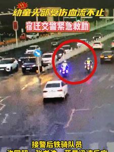 幼童头部受伤血流不止，宿迁交警紧急救助 